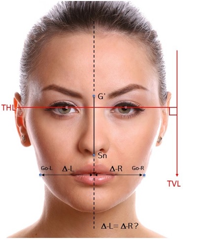 Facial Harmonization