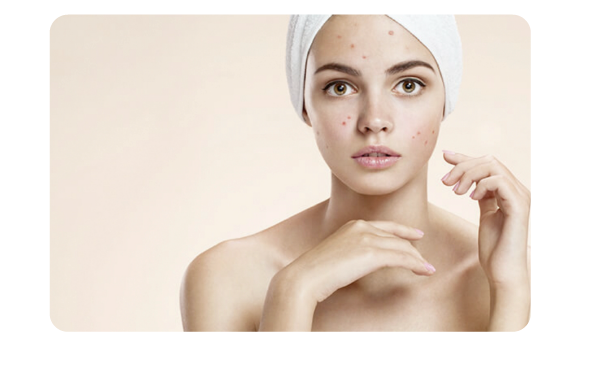 Medicated Facial