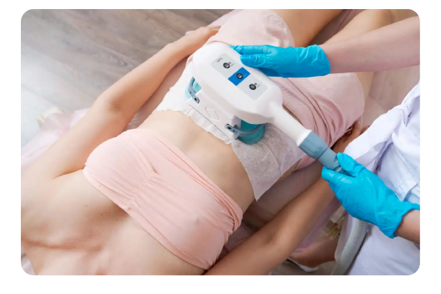 Freeze Fat/ Coolsculpting