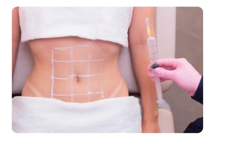 Injection Lipolysis Enzyme