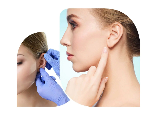 Ear Correction